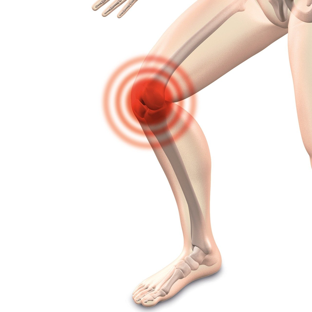 Arthrose – Schmerz lass nach!